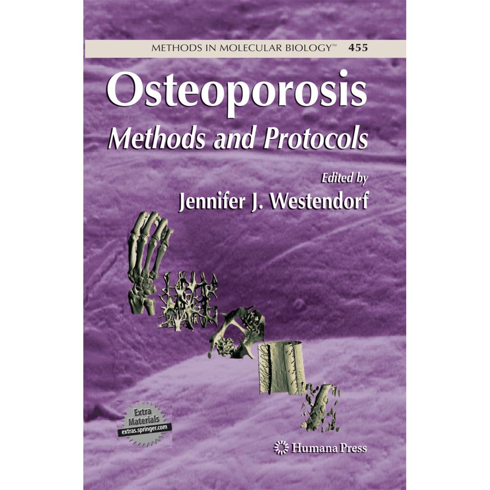 Osteoporosis, Fachbücher