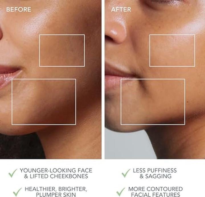 Actual product image Foreo Bear