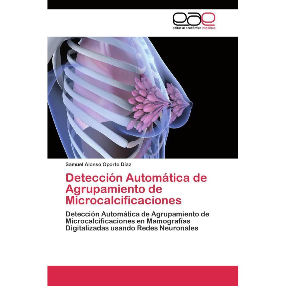 Detección Automática de Agrupamiento de Microcalcificaciones, Fachbücher von Samuel Alonso Oporto Díaz