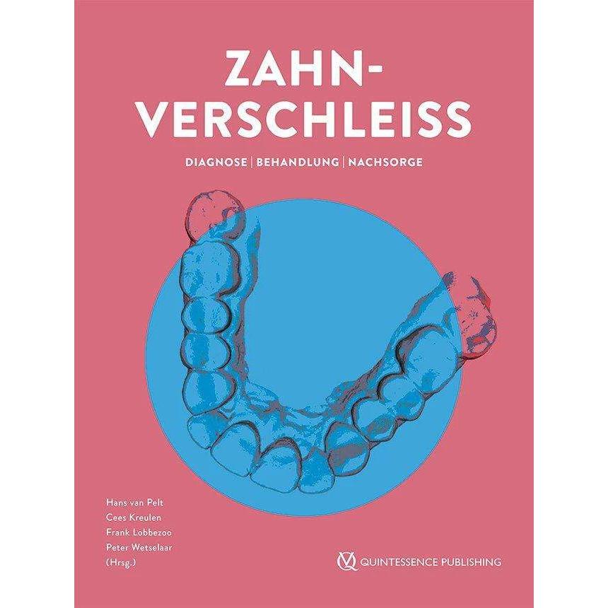 Thumbnail - Zahnverschleiss, Fachbücher von Cees Kreulen, Hans van Pelt, Peter Wetselaar, Frank Lobbezoo