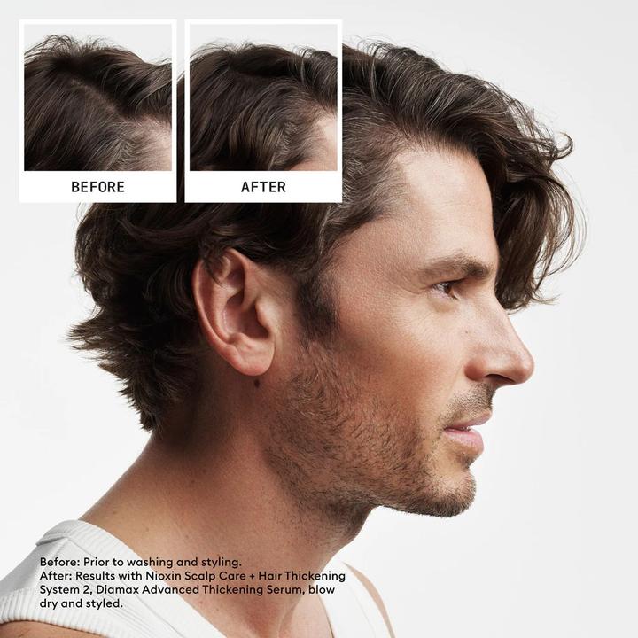 Actual product image Nioxin System 2 Kit 150ml Shampoo 150ml Conditioner 40ml Treatment Advanced Thinning Kit (Hair care set)