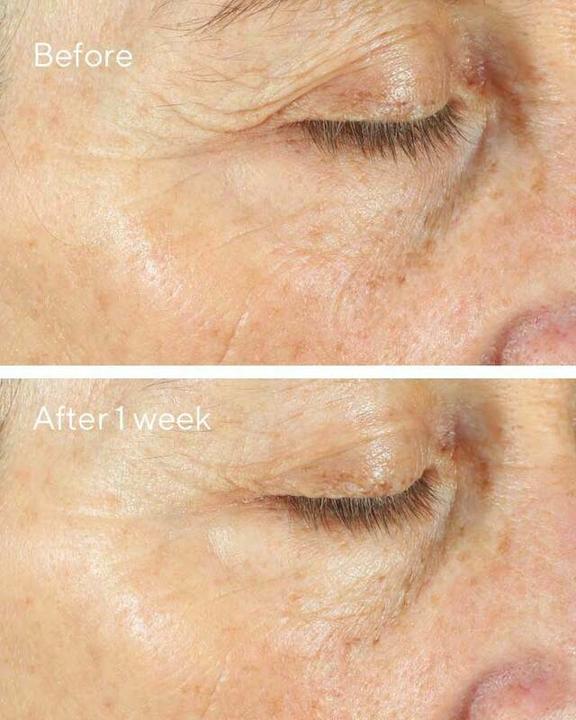 Immagine prodotto Murad 15293 Crema Giorno/Notte Donna Tutte le età 50 ml (50 ml)