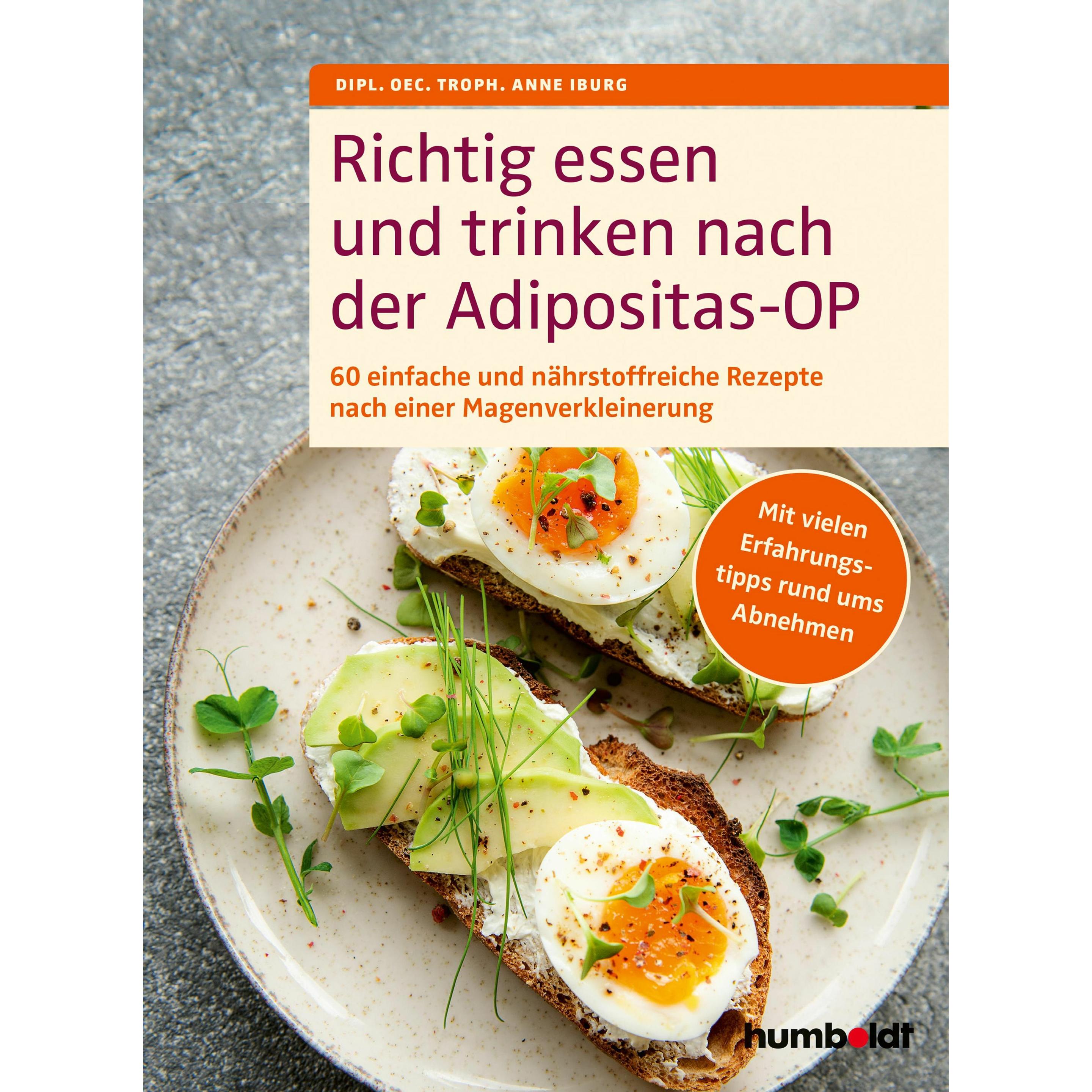 Richtig essen und trinken nach der Adipositas-OP, Ratgeber von Dipl. Oec. Troph. Anne Iburg