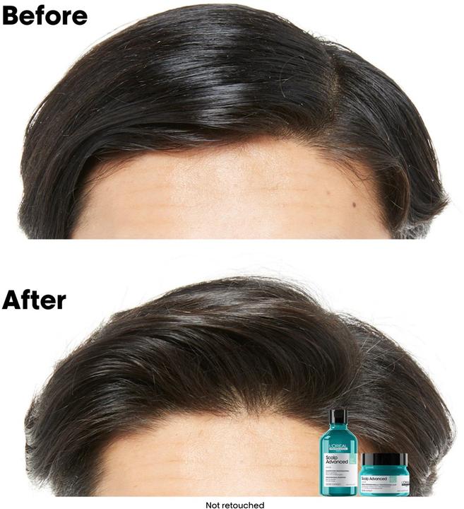 Produktbild L'Oréal Professionnel Scalp Advanced (250 ml)