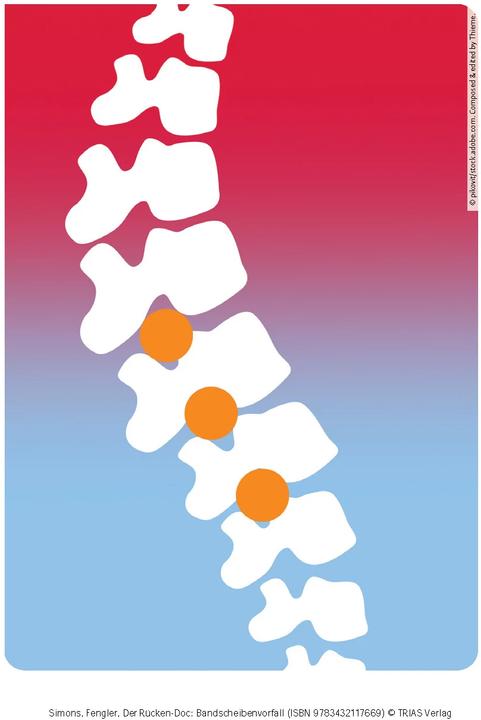 Produktbild Der Rücken-Doc: Bandscheibenvorfall (Deutsch, Arndt Fengler, Patrick Simons, 2023)