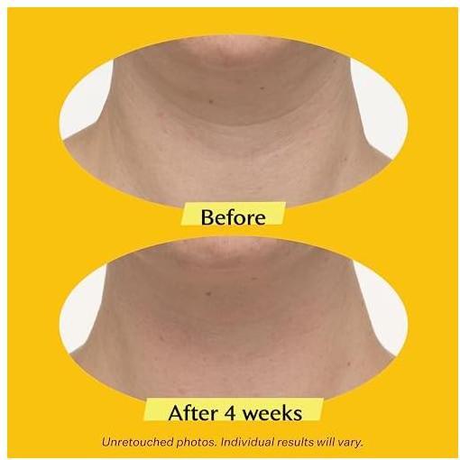 Image du produit StriVectin Raffermissement avancé (30 ml, Spray visage)