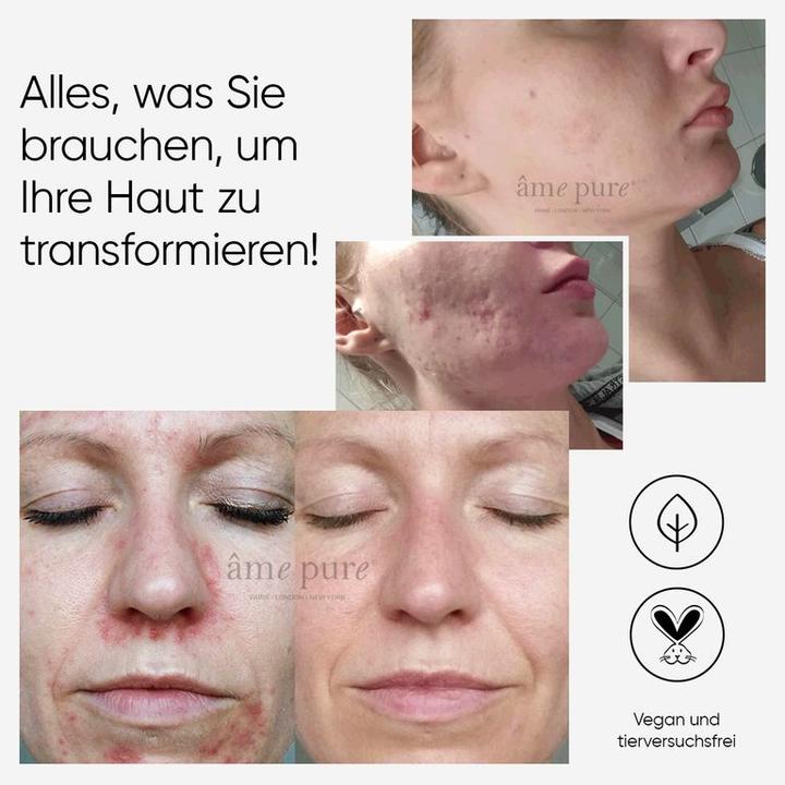 Actual product image Âme pure CIT Face Roller Platinum