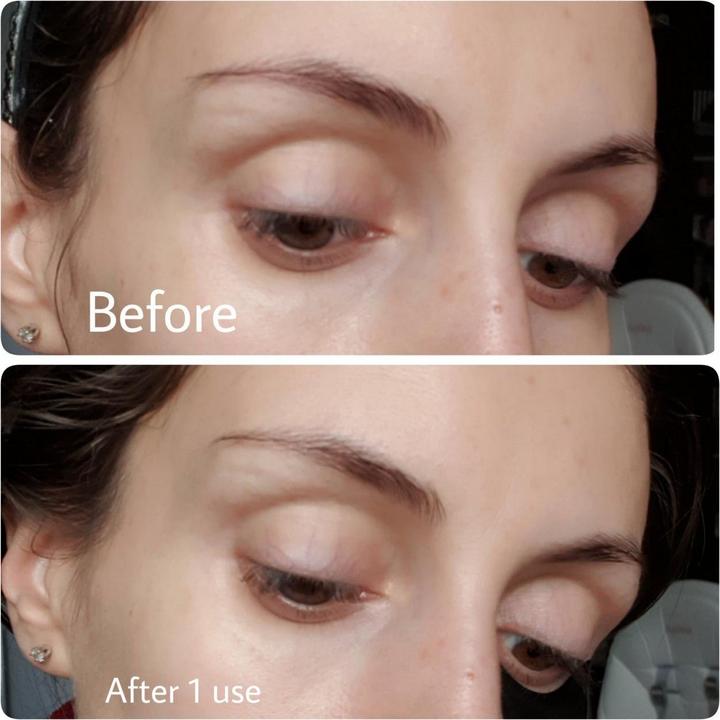 Image du produit Benton Snail Bee Ultimate Hydrogel Eye Patch (Patchs pour les yeux)