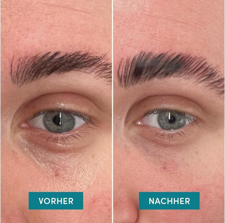 Actual product image Apricot Reusable Eye Pads Vitamin C “glow getter” (Eye patches)