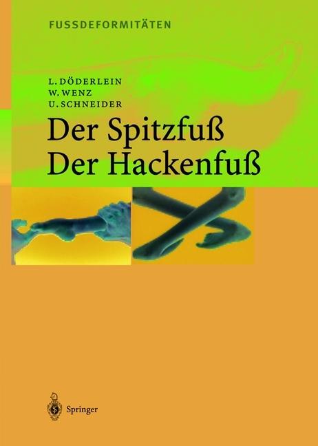 Produktbild Fussdeformitäten (Deutsch, Leonhard Döderlein, Urs Schneider, Wolfram Wenz, 2012)