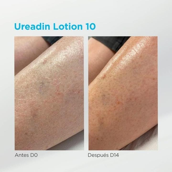 Produktbild Isdin Ureadin Lotion10 Intensive Hydratation 200ml (Körperlotion, 200 ml)