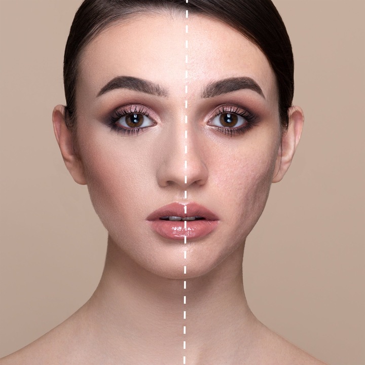 Produktbild Mesauda Face - Pro Light Concealer W20 (W20)