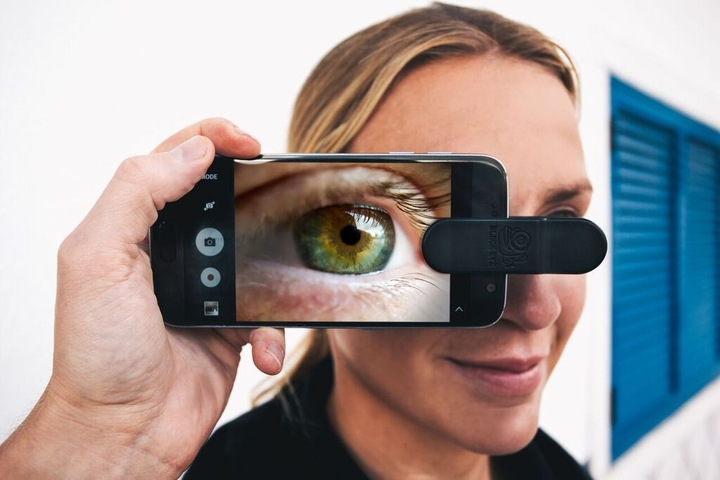 Actual product image Black Eye 3in1 Combo Kit G4 Lens