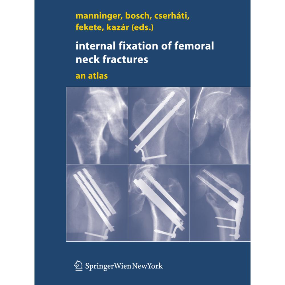 Internal fixation of femoral neck fractures, Fachbücher von Peter Cserháti, György Kazár, Ulrich Bosch, Károly Fekete, J...