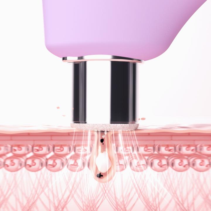 Produktbild Foreo Kiwi Derma