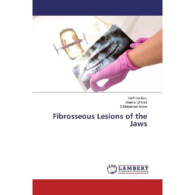 Fibrosseous Lesions of the Jaws, Fachbücher von Karthika Balu, Shams Ul Nisa, S.Mohamed Anser