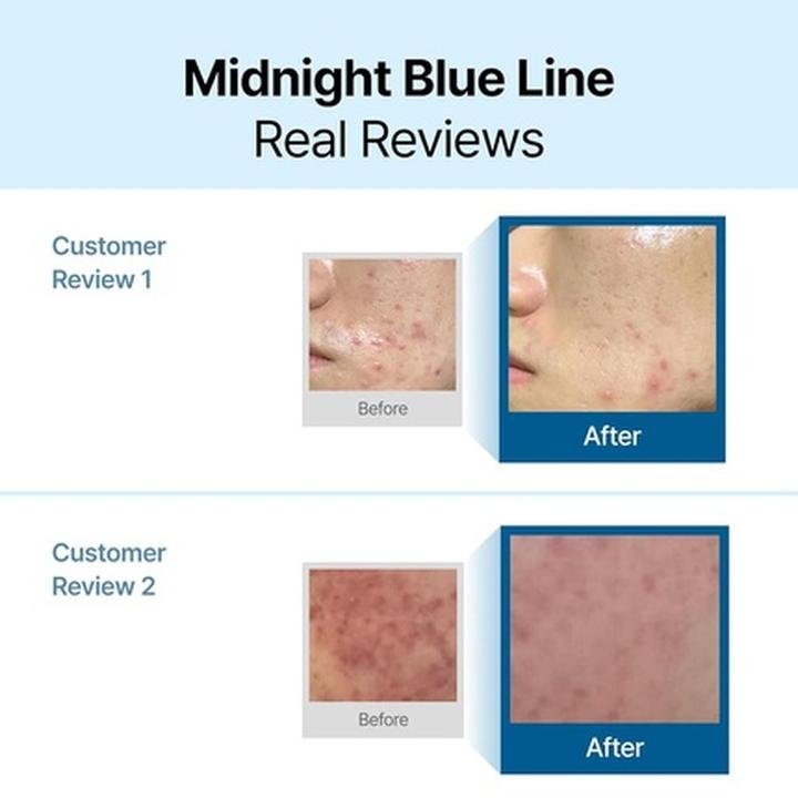 Actual product image Klairs Midnight Blue (30 ml, Day cream)