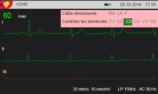 Produktbild Ruhe-EKG Cardiovit AT-1 G2 mit Interpretationsoption