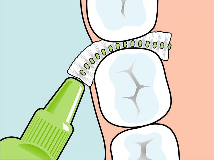 Immagine prodotto TePe Interdentalbürsten Original Grün ISO 5 (8 x, 0.80 mm)