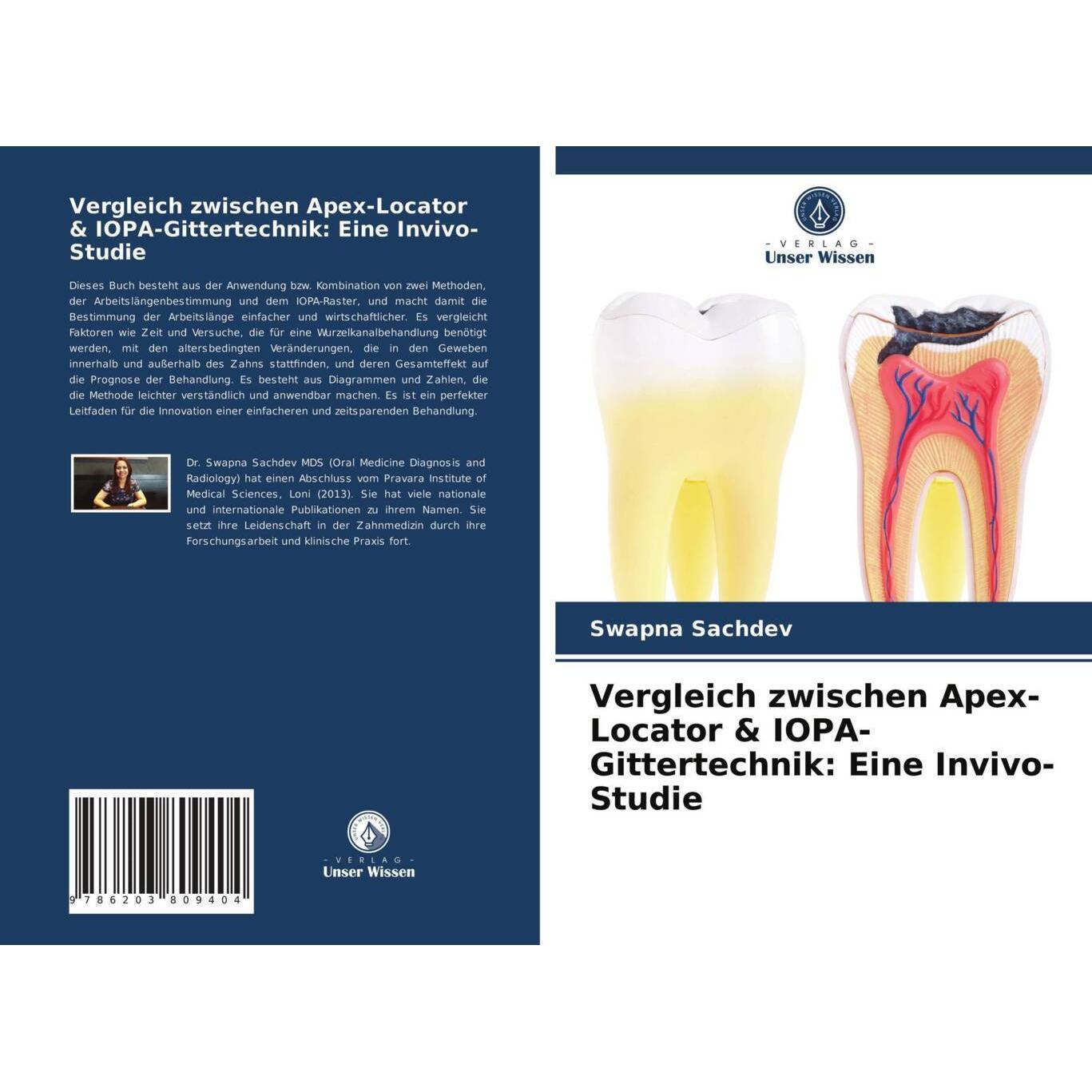 Vergleich zwischen Apex-Locator & IOPA-Gittertechnik: Eine Invivo-Studie, Fachbücher von Swapna Sachdev
