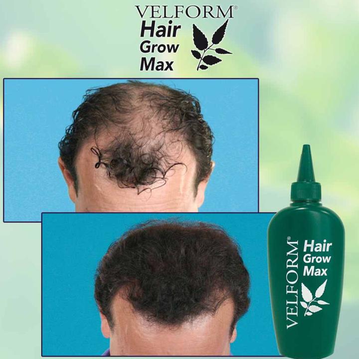 Image du produit Velform Hair Grow Max (200 ml)