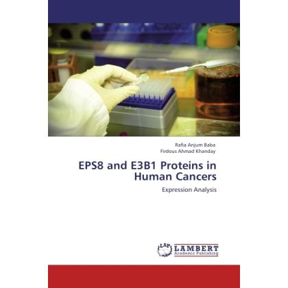 EPS8 and E3B1 Proteins in Human Cancers, Fachbücher