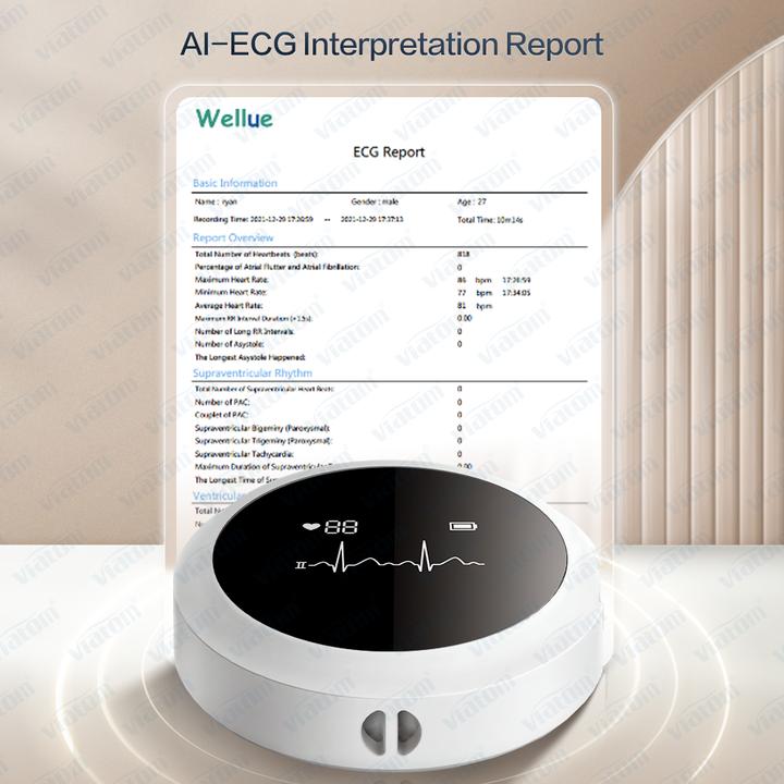 Produktbild ViatomTech Lepod Pro 12-lead 48Hrs Real-time ECG Recorder