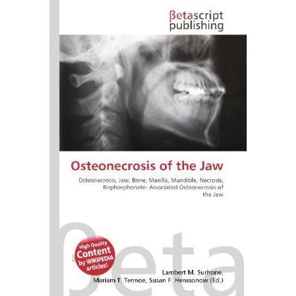 Osteonecrosis of the Jaw, Fachbücher von Lambert M. Surhone, Miriam T. Timpledon, Susan F. Marseken