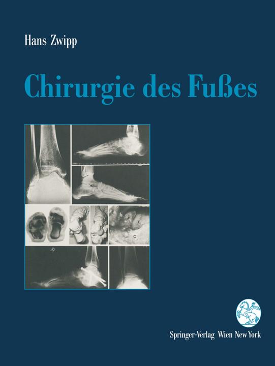 Produktbild Chirurgie des Fusses (Deutsch, Hans Zwipp, 2012)