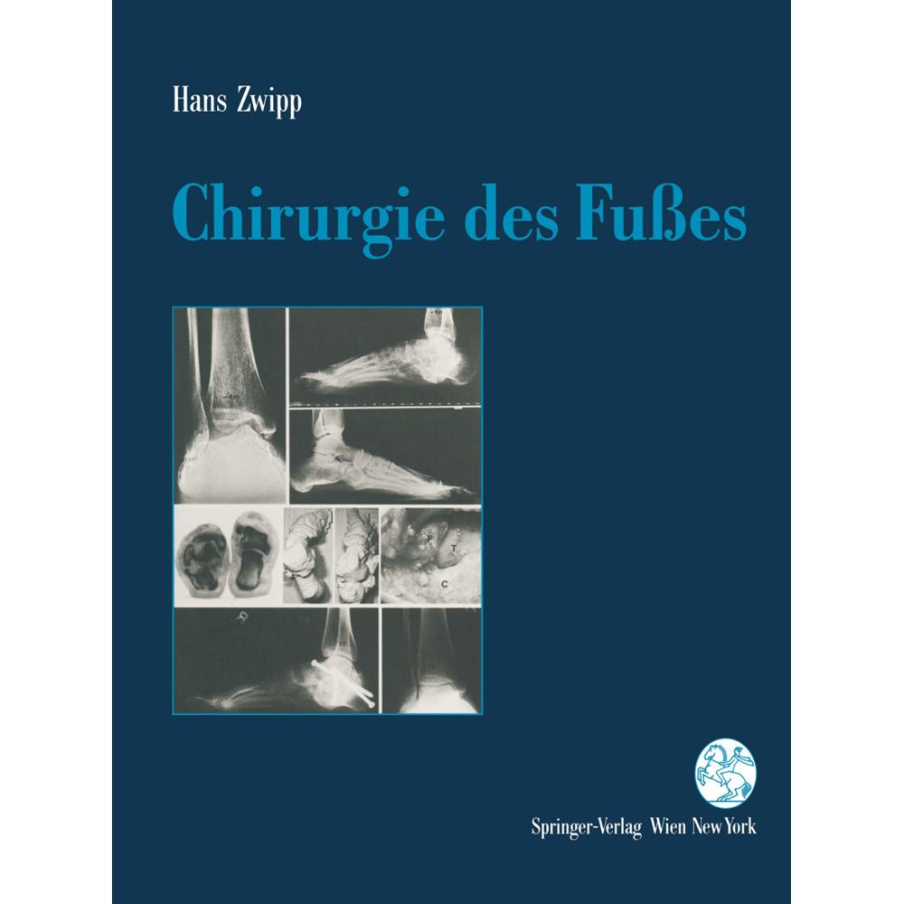 Chirurgie des Fusses, Fachbücher von Hans Zwipp