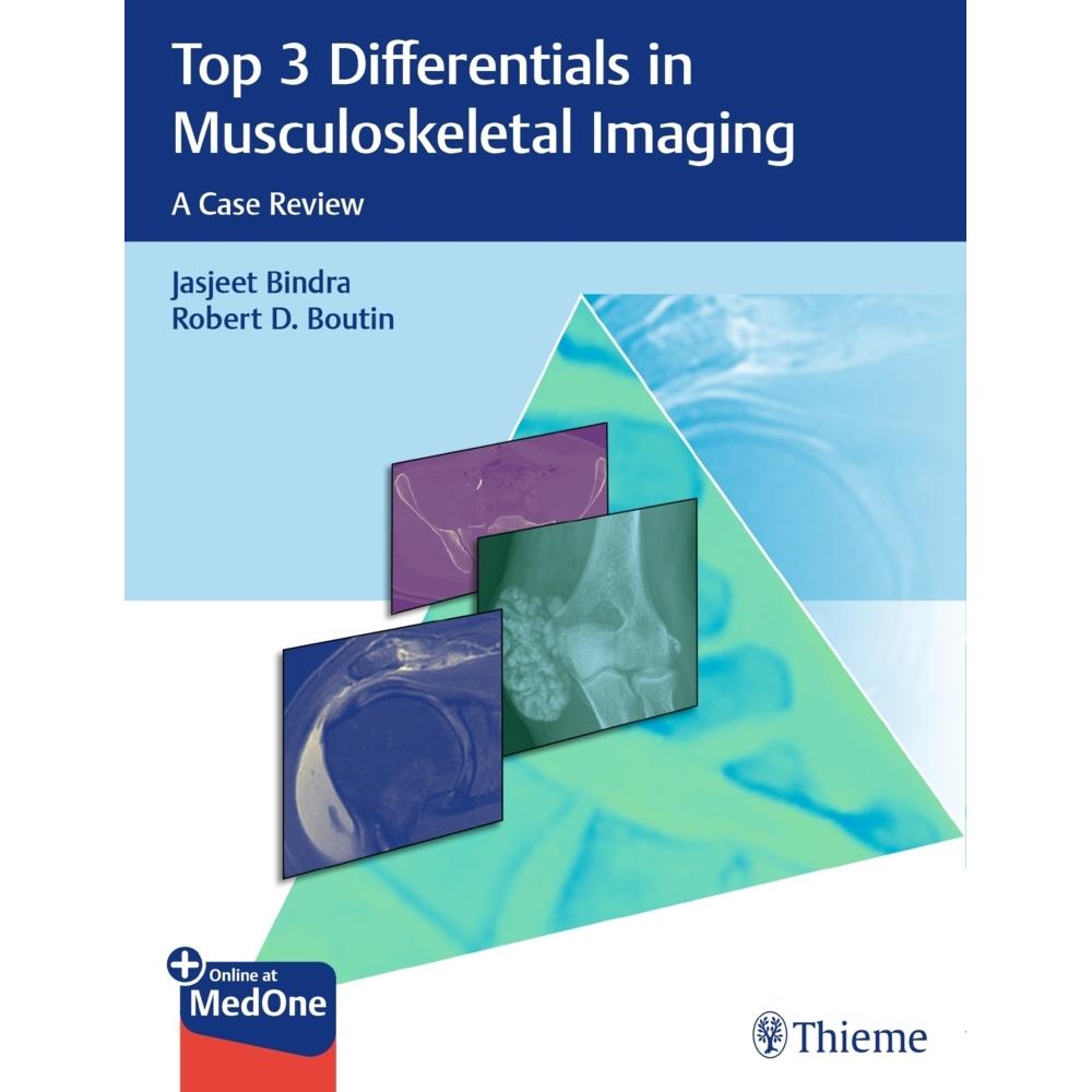 Bindra:Top 3 Differentials in Musculosk, Fachbücher von Thieme Publishers New York, 1. Edition (24. Februar 2021)