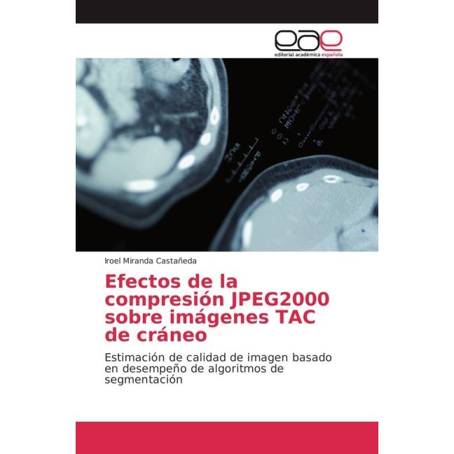 Efectos de la compresión JPEG2000 sobre imágenes TAC de cráneo, Fachbücher