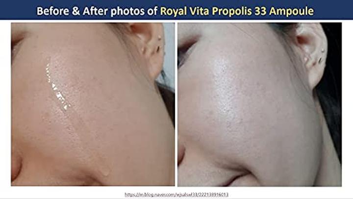 Produktbild Dr. Ceuracle Honey Nourishing Essence Royal Vita Propolis 33 Ampoule Korean Skin Care with Royal Jelly Extract an (30 ml)