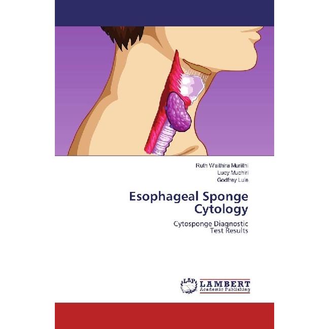 Esophageal Sponge Cytology, Fachbücher von Godfrey Lule, Ruth Waithira Muriithi, Lucy Muchiri
