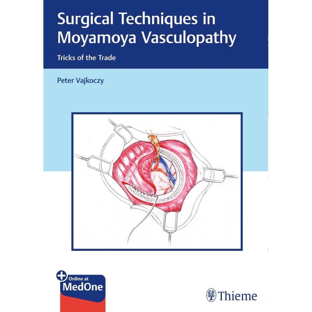 Vajkoczy:Surgical Techniques in Moyamoy, Fachbücher von Peter Vajkoczy