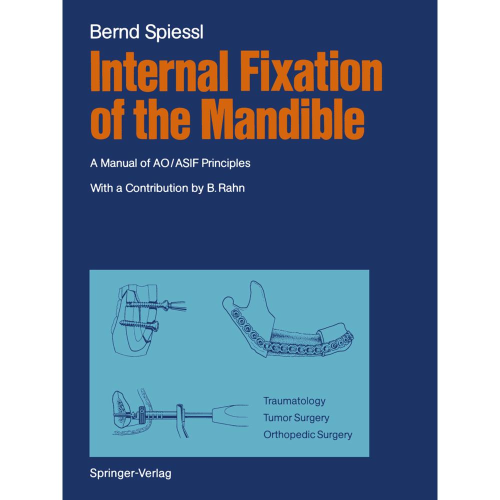 Internal Fixation of the Mandible, Fachbücher von Bernd Spiessl