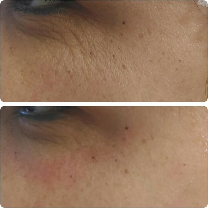 Produktbild Skinthings Skin Refiner Nano