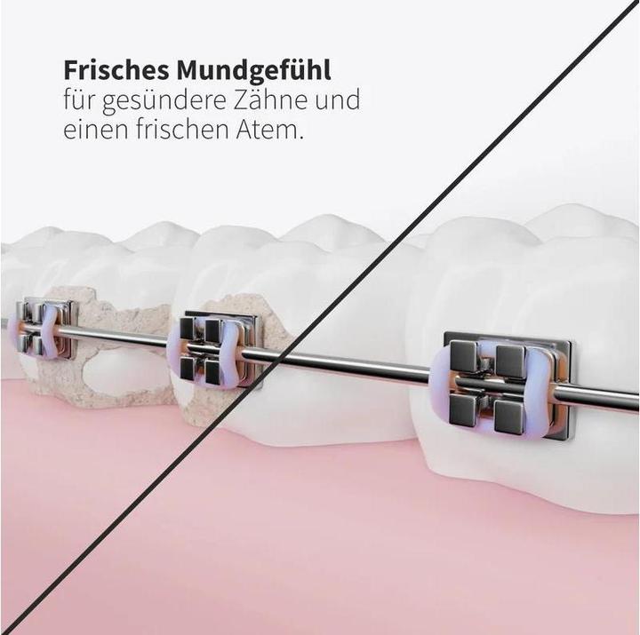 Produktbild Zahnheld Ersatzdüsen Basic 3x Schwarz