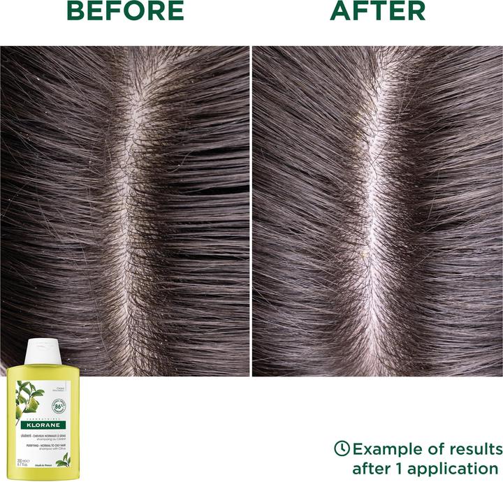 Produktbild Klorane Zedrat Shampoo revitalisierend (400 ml, Flüssiges Shampoo)