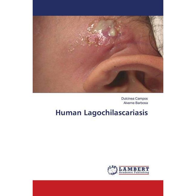 Human Lagochilascariasis, Fachbücher von Dulcinea Campos, Alverne Barbosa