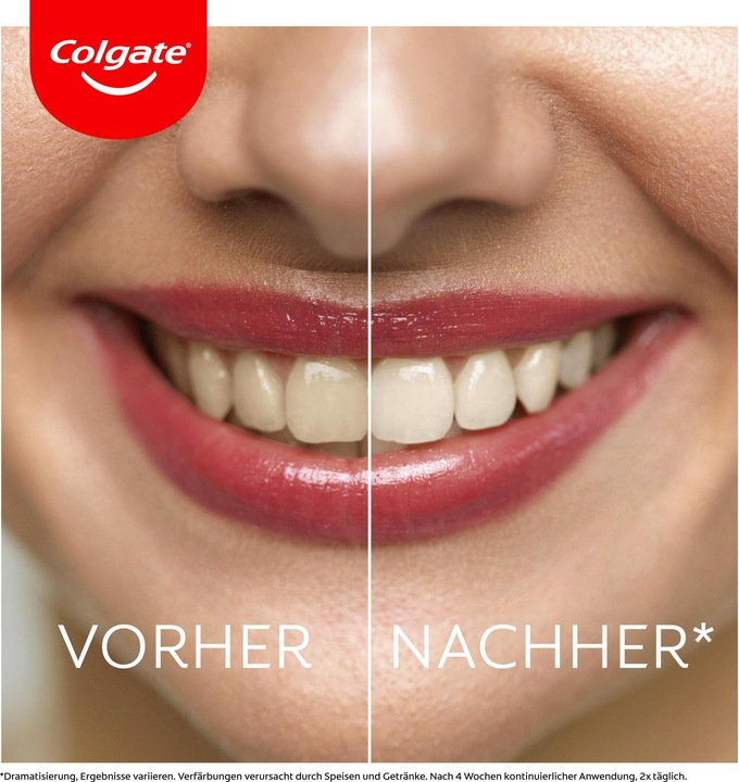 Actual product image Colgate Max White Ultra Active Foam Whitening (50 ml)