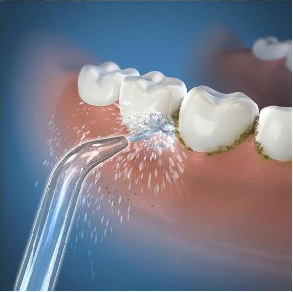 Produktbild Waterpik Standard JT-450 (Mundduschenaufsätze)