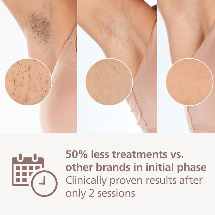Image du produit Philips Lumea IPL Series 9000