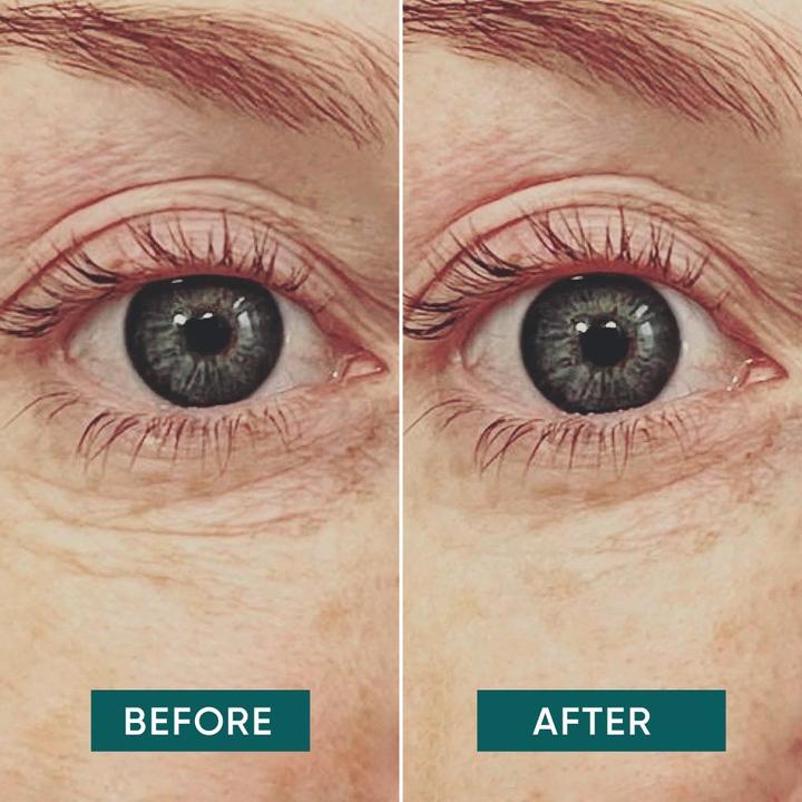 Image du produit Apricot Eye Pads Hyaluron