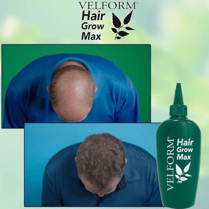 Produktbild Velform Hair Grow Max (200 ml)