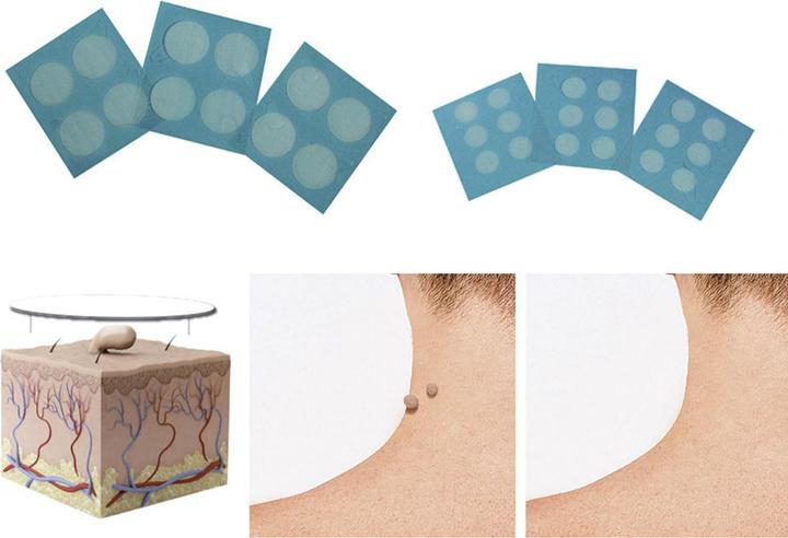 Produktbild Formu Clear Skin Tag Patch (Fussdeodorant & -puder)