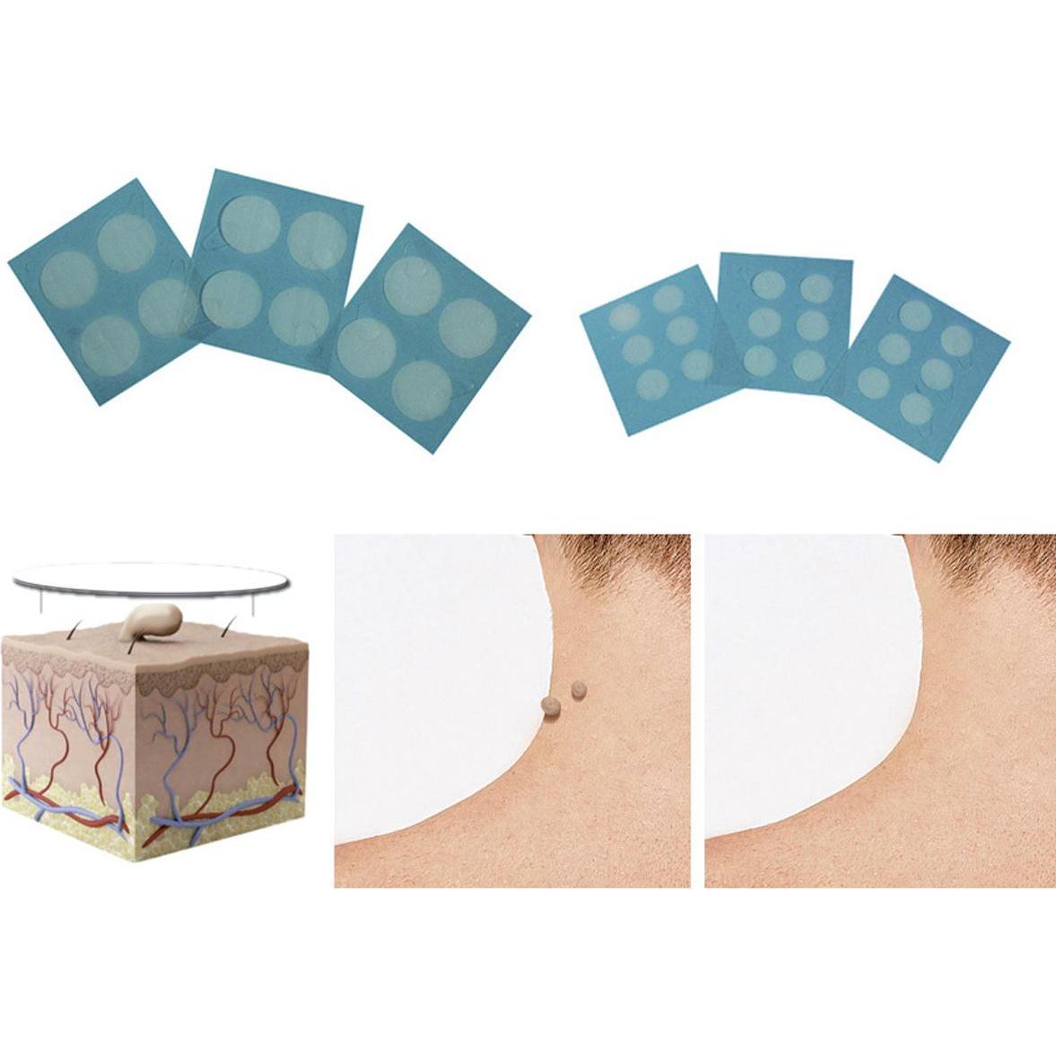 Thumbnail - Formu Clear, Fusspflegemittel, Skin Tag Patch (Fussdeodorant & -puder)