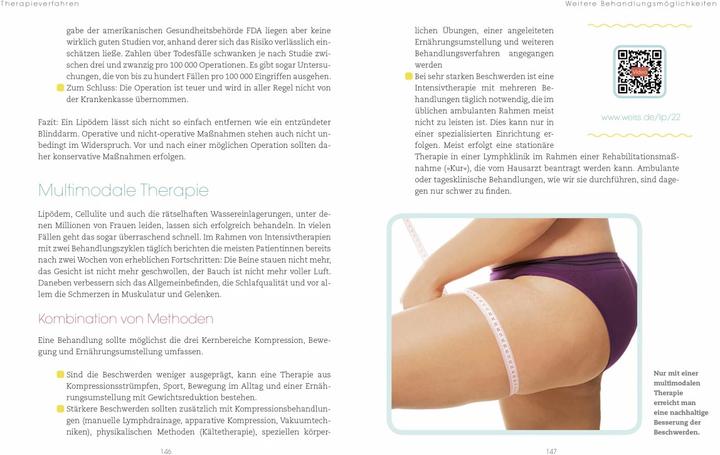 Actual product image Lipödem (German, Thomas Weiss, 2015)