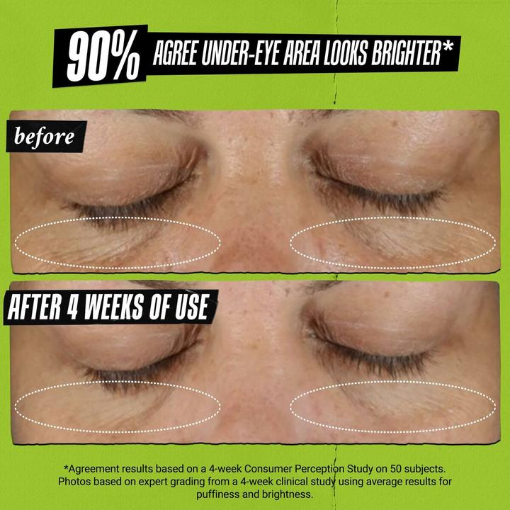 Produktbild Kiehl's Creamy Eye Treatment (Augenpflege Crème, Tag + Nacht, 28 ml)