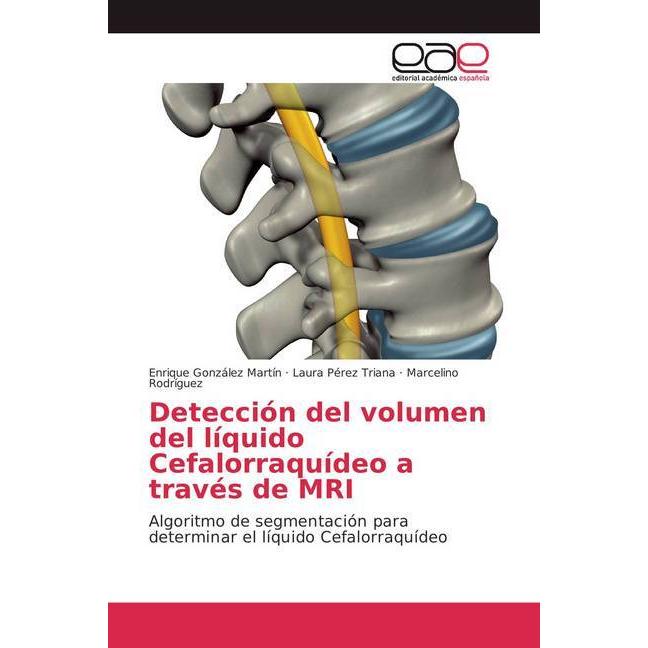 Detección del volumen del líquido Cefalorraquídeo a través de MRI, Fachbücher von Enrique González Martín, Laura Pérez T...